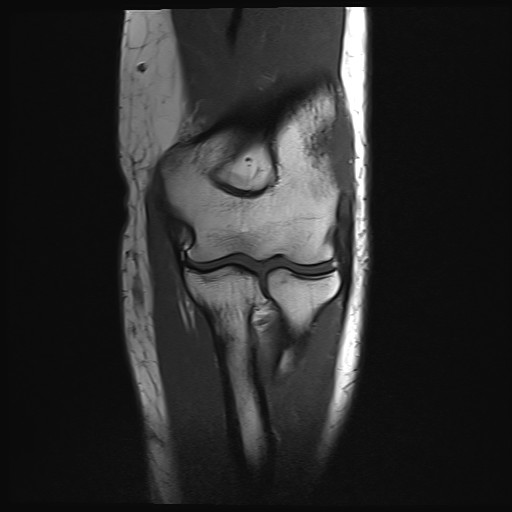 Click on the Serie image to view the images of Wieszt, Gnter